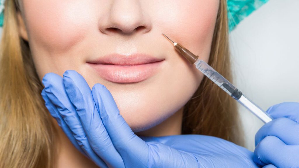 Lip Filler Simulation for Your Ideal Aesthetic!