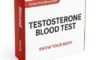 Testosterone Blood Test Guide: Essential Information for Slough